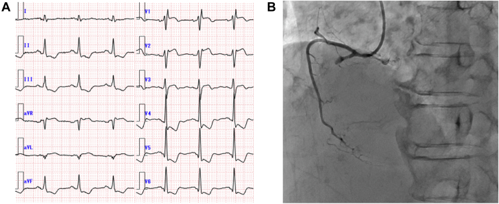 Figure 1