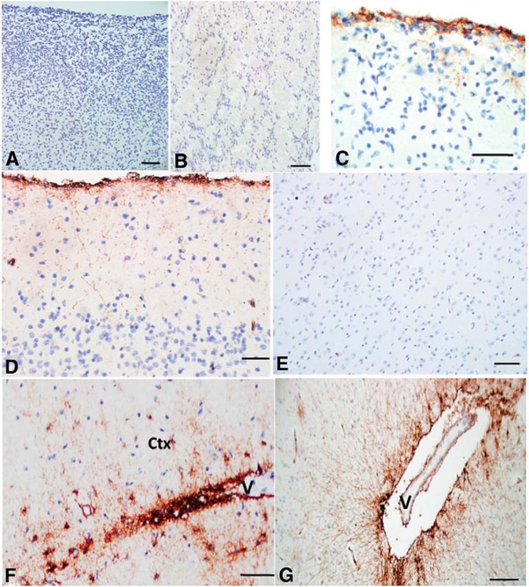 Figure 11.