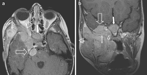 Fig. 2