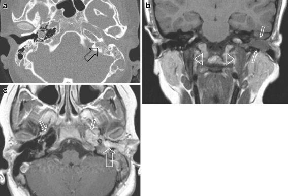 Fig. 4