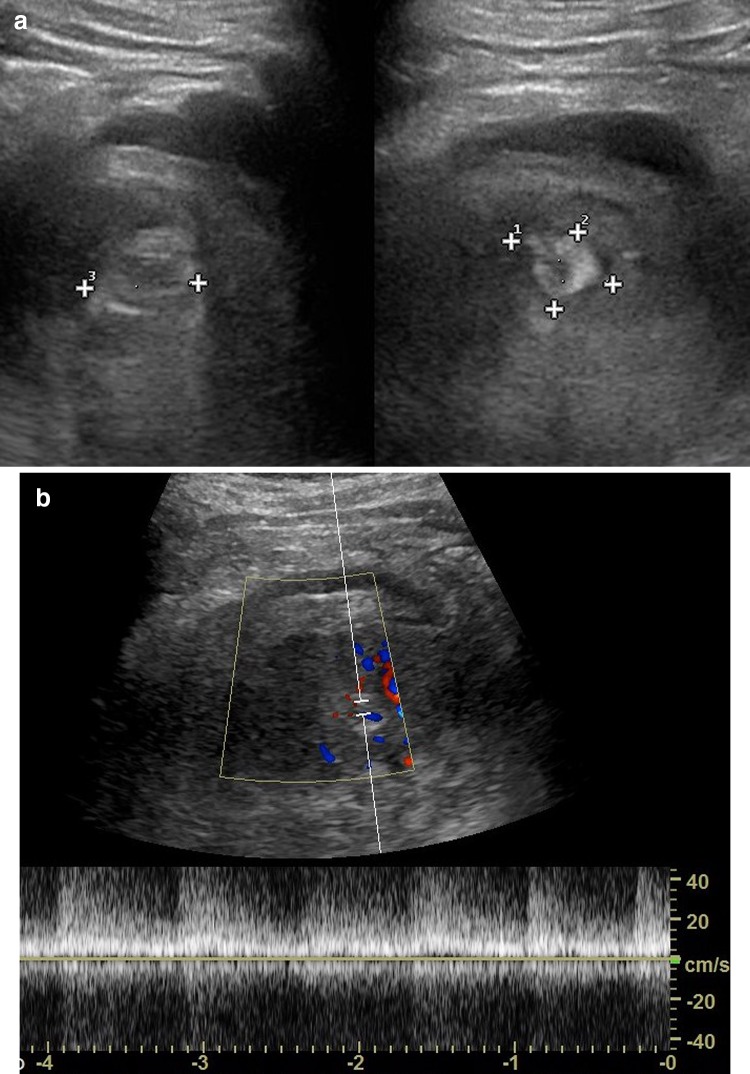 Fig. 1