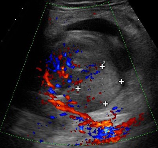 Fig. 2