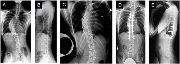 Fig 3