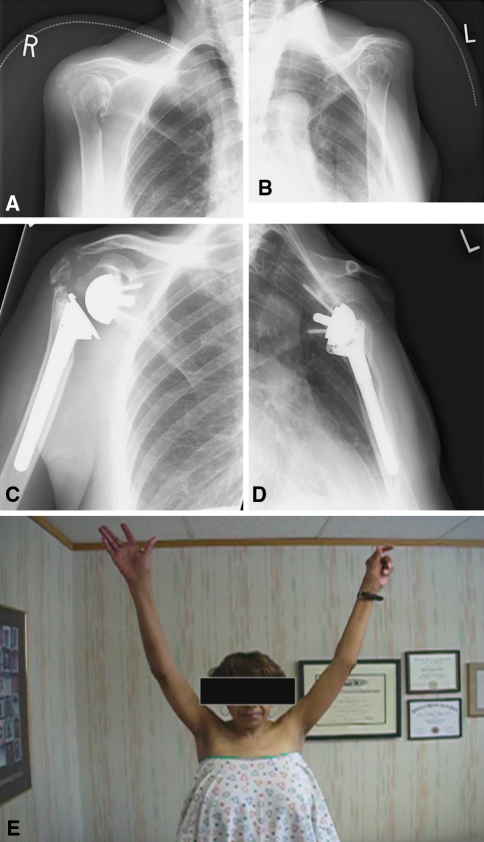 Fig. 2A–E