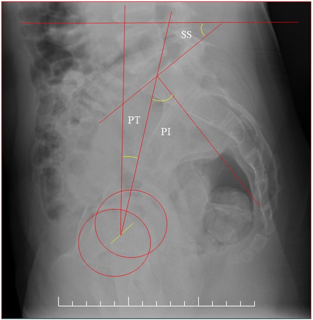 Figure 2