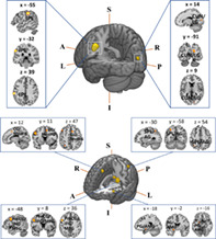 graphic file with name HBM-43-4864-g005.jpg