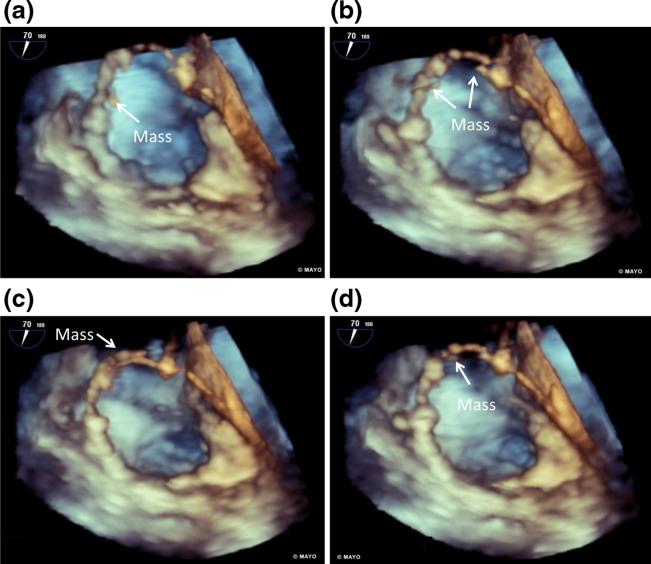 Fig. 5