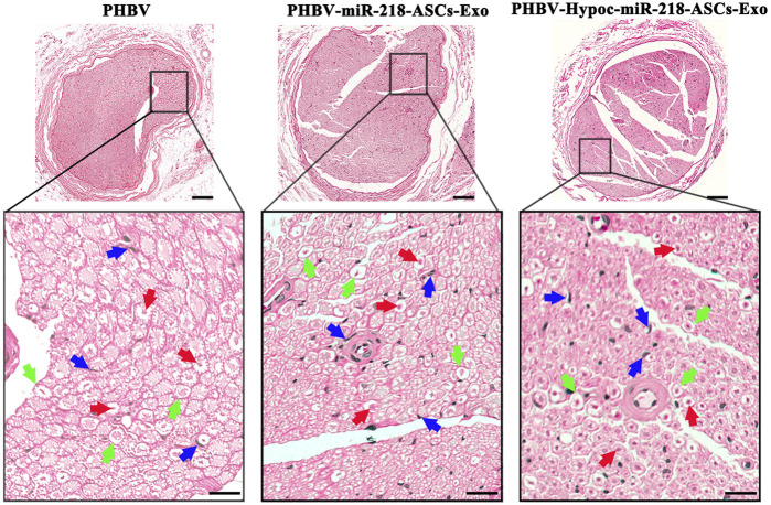 FIGURE 14