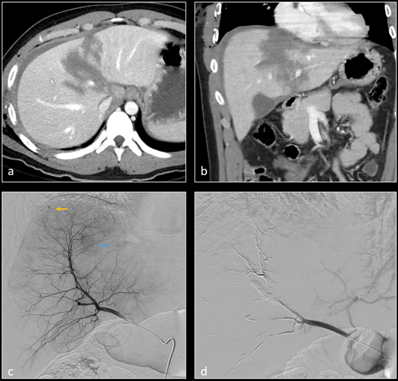 Fig. 9