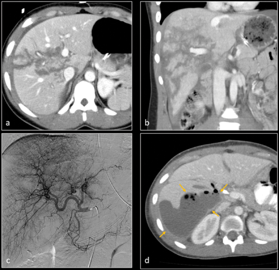 Fig. 12