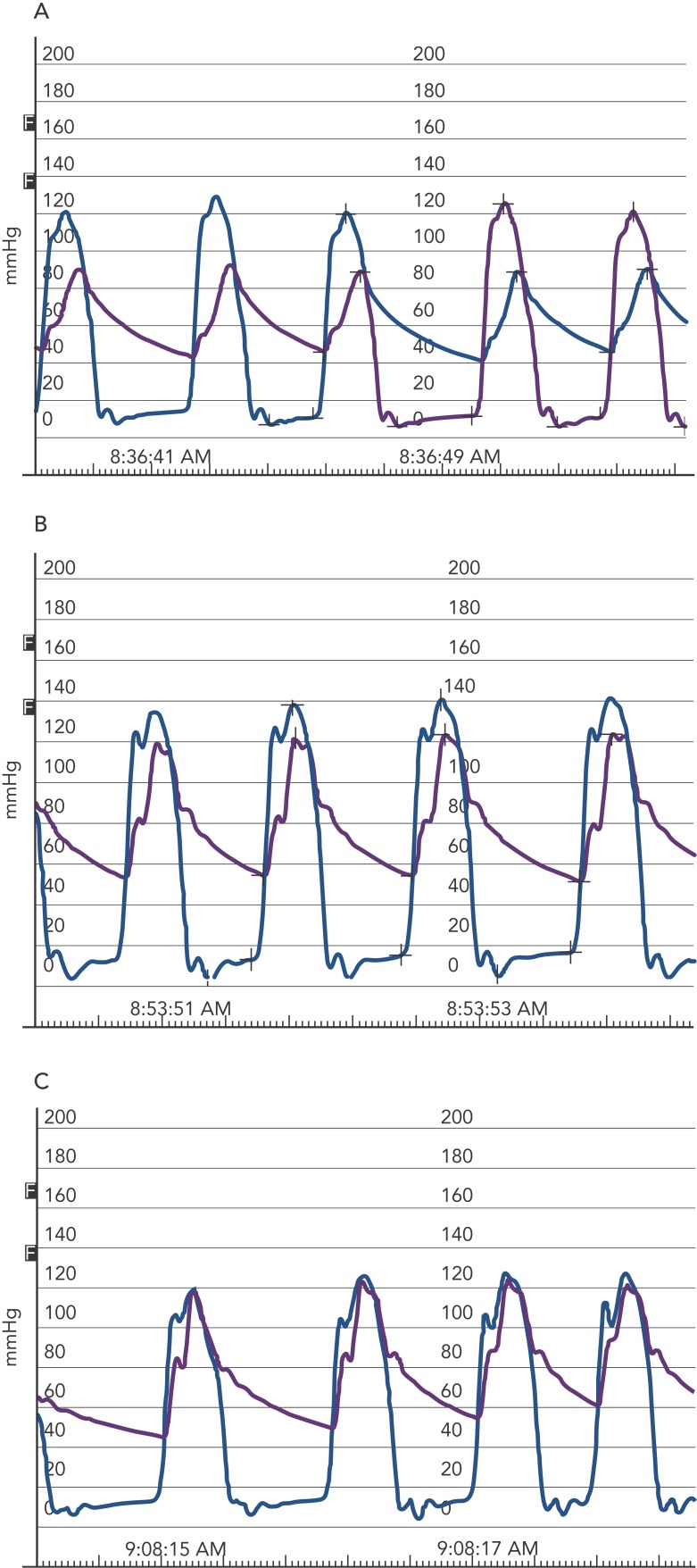 Figure 4: