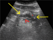 Fig. 8 A