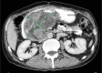 Fig. 9 C