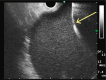 Fig. 3 A