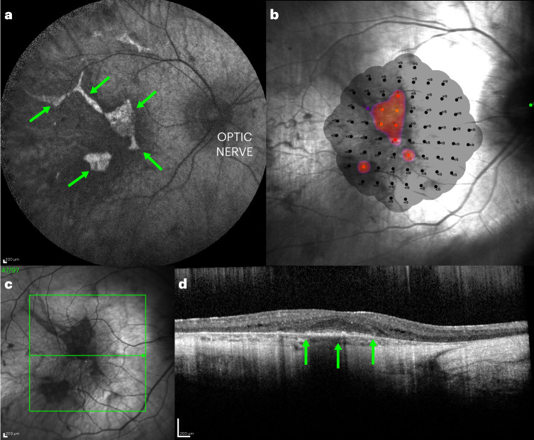 Fig. 1
