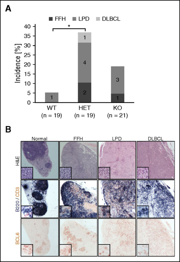 Figure 5. FBXO11 deletion in mice leads to lymphoproliferative disease. (A) Incidence of florid follicular hyperplasia (FFH), lymphoproliferative disease (LPD), and DLBCL in 17- to 18-month-old FBXO11+/+-Cγ1cretg/+ (WT), FBXO11fl/+-Cγ1cretg/+ (HET), and FBXO11fl/fl-Cγ1cretg/+ (KO) mice. N = number of analyzed mice; *P < .05 (1-way ANOVA). (B) Lymph node sections representative of no pathology (normal), FFH, LPD, and DLBCL were stained with hematoxilin/eosin (H&E), B220 (blue) and CD3 (brown), or BCL6 as indicated. Images were acquired using 10× and (for the insets) 20× objectives leading to an overall magnification of ×100 and ×200, respectively.