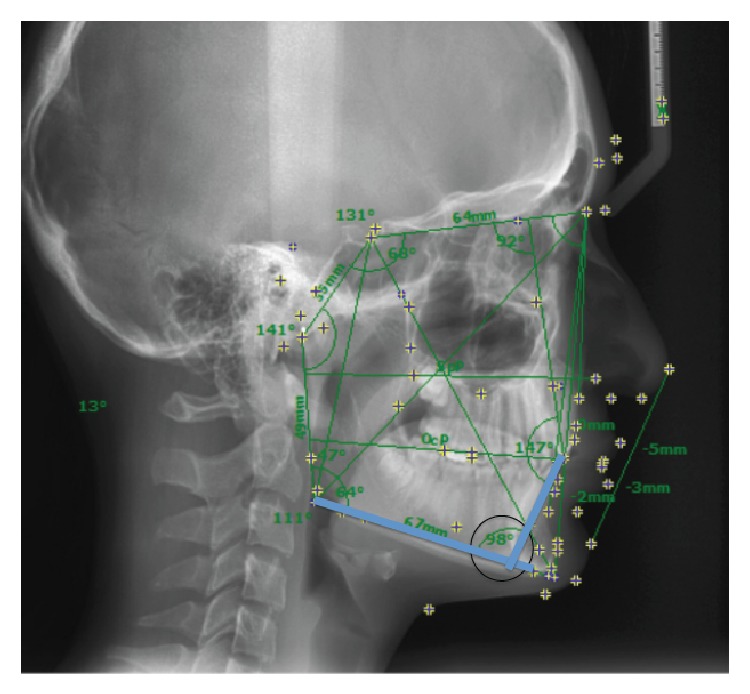 Figure 1