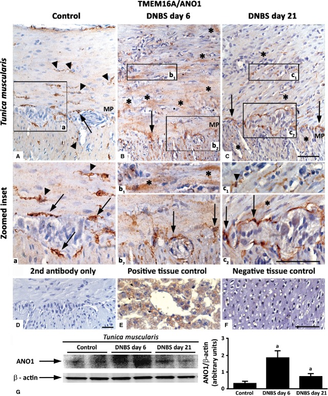 Fig 12