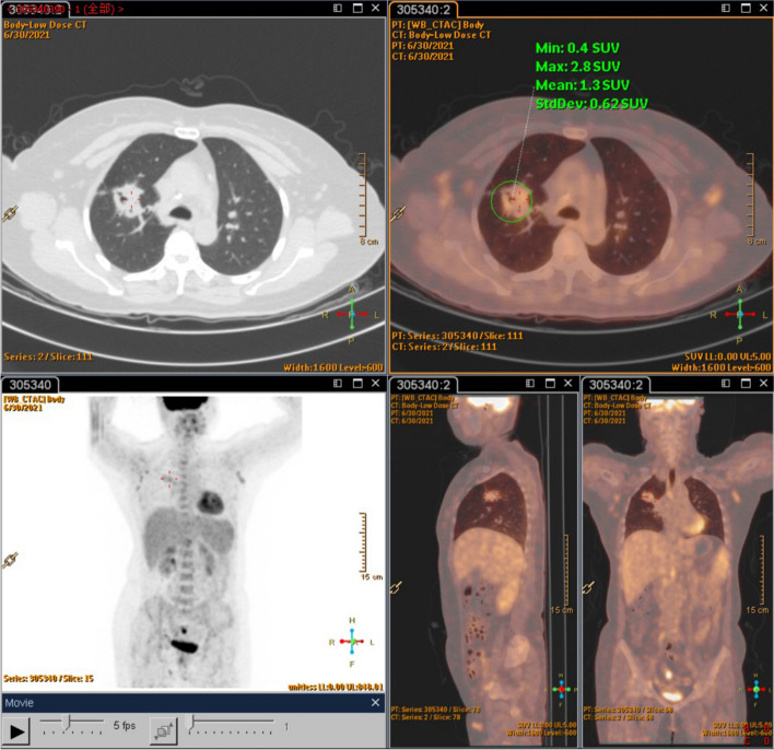 Fig. 2