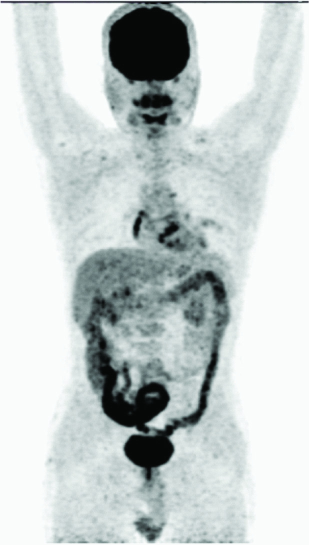 [Table/Fig-2a]: