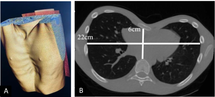 Fig. 6