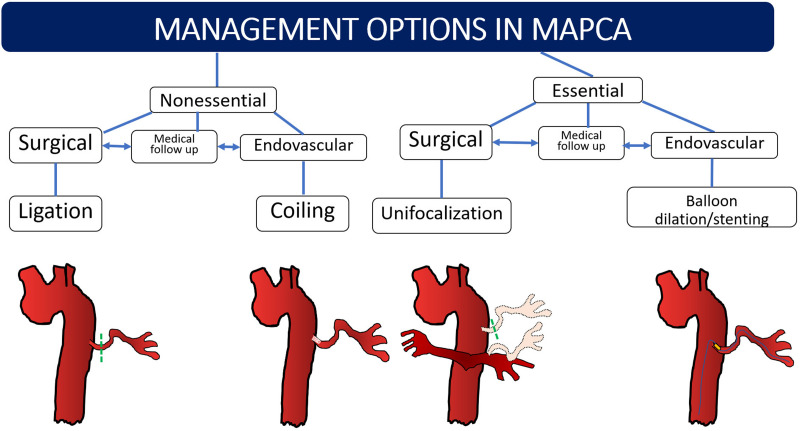 Summary of management options in major aortopulmonary collateral arteries (MAPCAs) in general. Essential MAPCAs require either unifocalization or endovascular stent placement or angioplasty. Nonessential and dilated MAPCAs are coiled or ligated. Nonessential stenosed MAPCAs may be kept under medical follow-up before or after surgery and addressed later. If all essential MAPCAs cannot be unifocalized in a single stage, the remaining MAPCAs are followed-up until the next stage of repair.