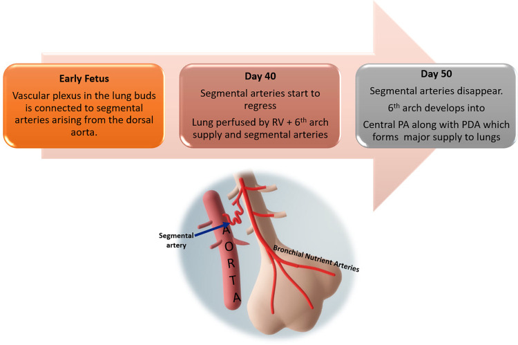 Flowchart depicts the normal pulmonary vasculature development with regression of the segmental arteries as the pulmonary artery develops from the sixth branchial arch. PA = pulmonary artery, PDA = patent ductus arteriosus, RV = right ventricle.