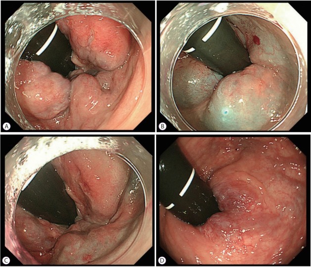 Fig. 2.