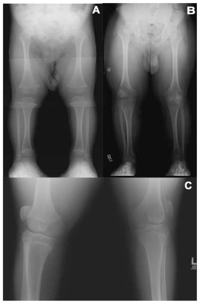 FIG. 3