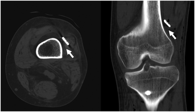 Fig. 12