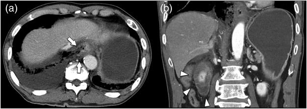 Figure 1: