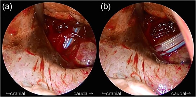 Figure 3: