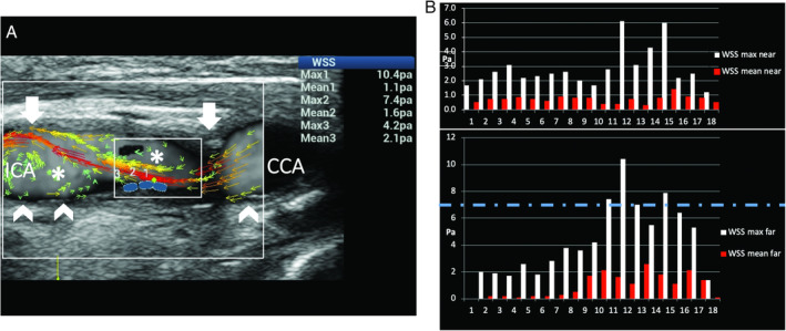 Figure 14