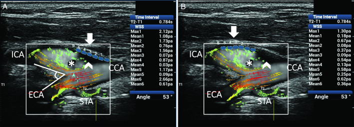 Figure 12