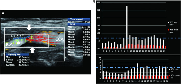 Figure 15