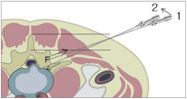 Fig. 2