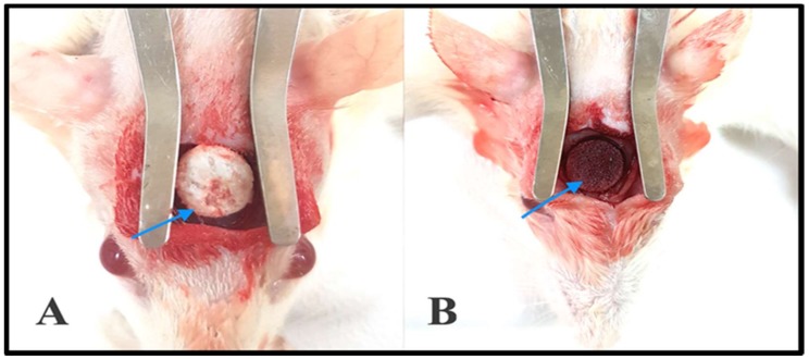 Figure 11