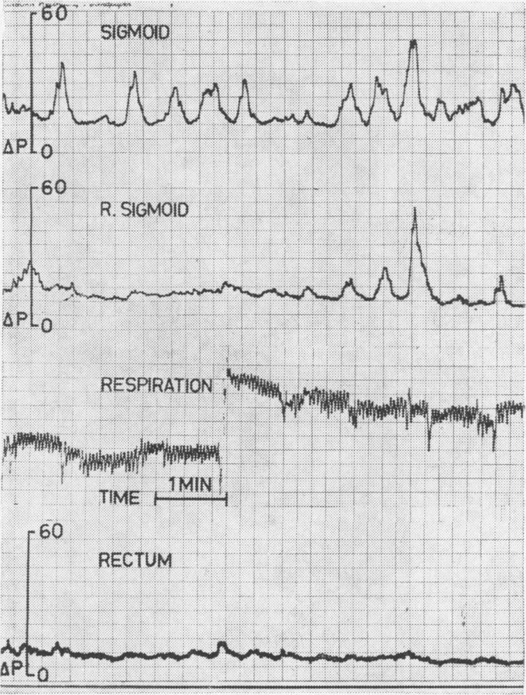 FIG. 6a