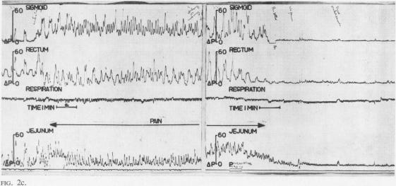 FIG. 2c