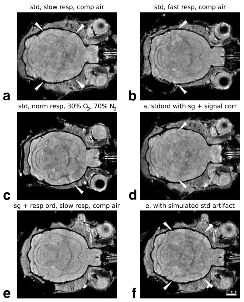 FIG. 5