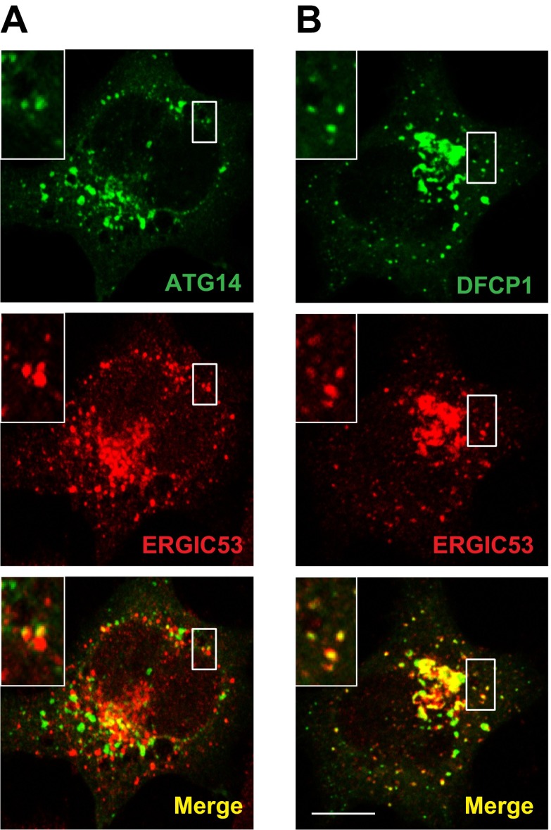 Figure 12—figure supplement 2.