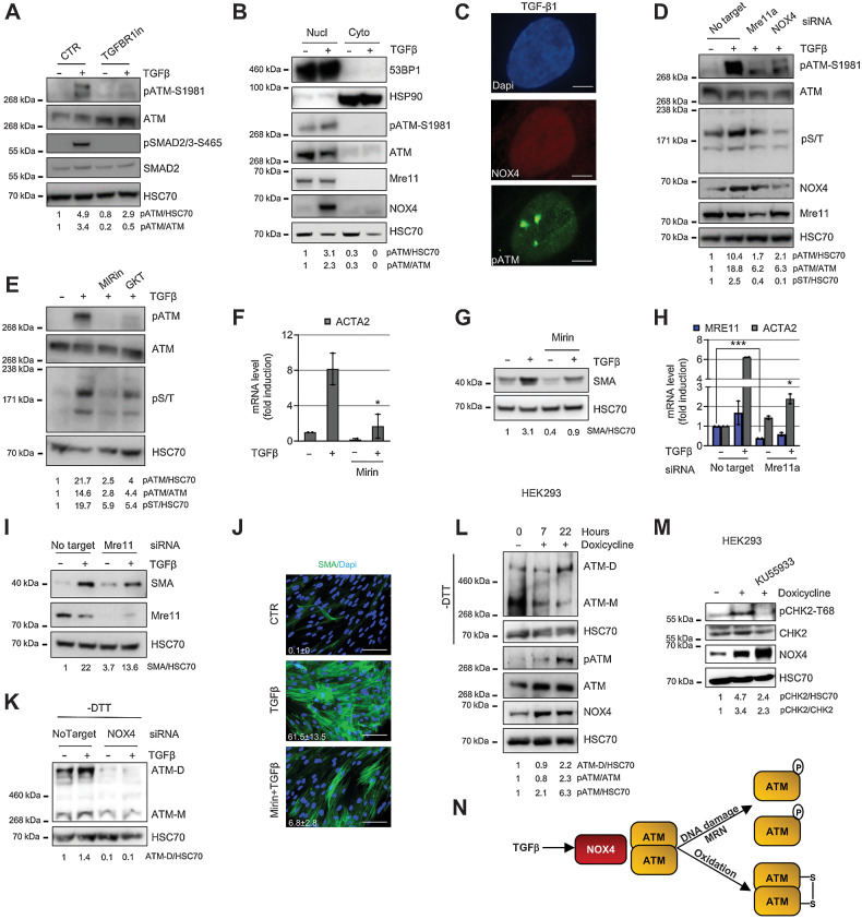 Figure 4. TGFβ activates ATM via NOX4-driven DNA damage/MRN complex and oxidation. A–E, HFFF2 were treated with TGFβ1 for 24 hours. A, Western blotting/quantification of HFFF2 treated with TGFβR1 inhibitor; B, Western blotting/quantification of nucleus/cytoplasm extracts using HSP90 and 53BP1 as cytoplasmic and nuclear marker, respectively. C, Representative immunofluorescence staining for NOX4 and pATM (scale bar = 5 μm). D, Western blotting/quantification of HFFF2 transfected as indicated. E, Western blotting/quantification of HFFF2 treated with inhibitors of MRE complex inhibitor (Mirin, 40 μmol/L) or NOX4 (GKT137831; 40 μmol/L). F–G, qRT-PCR (F; ntr = 3) and Western blotting/quantification (G) of HFFF2-treated TGFβ1 for 72 hours ± 40 μmol/L Mirin. H and I, qRT-PCR (H; ntr = 3) and Western blotting/quantification (I) of IMR90 fibroblasts transfected as indicated and treated with TGFβ1 for 72 hours. J, Representative immunofluorescent staining of SMA-positive stress fibers and relative quantification of the mean in HFFF2 treated with TGFβ1 for 72 hours ± Mirin (40 μmol/L; scale bar = 100 μm; FoV = 10). K, Western blotting/quantification of HFFF2 transfected as indicated and treated with TGFβ1 for 48 hours; gel run in nonreducing -Dithiothreitol (DTT) conditions for ATM dimer (ATM-D). L, Western blotting/quantification (±DTT) of NOX4-inducible HEK-293 cells treated with doxycycline over time. M, Western blotting/quantification of NOX4-inducible HEK-293 cells treated with doxycycline ± KU55933 for 22 hours. N, Schematic diagram of the main findings in the figure. Heteroscedastic Student t test is used in the figure and refers to the TGFβ1-treated samples unless otherwise highlighted.