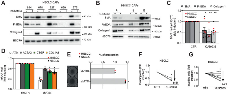 Figure 3. ATM inhibition reverses the myofibroblast CAF phenotype and inhibits function. A–C, Western blotting of HNSCC (A) and NSCLC (B) CAF treated with KU55933 for 7 days and their quantification (C). D, Q-RT-PCR of CAF (NSCLC, n = 1), HNSCC, n = 2) stably expressing either shCTR or shATM (ntr = 3). E, Collagen gel contraction assay and measurement of gel area of shCTR or shATM HNSCC and NSCLC CAF (representative gel images are shown on the left; ntr = 2). F–G, Transwell invasion assays of H441 (F) or 5PT (G) cells toward CAF-conditioned media generated from NSCLC (nbr = 3, ntr = 3–5; F) and HNSCC (nbr = 8; ntr = 2–4; G) treated as in A (means are shown and two-way ANOVA is used and refers to the control). Heteroscedastic Student t test is shown throughout the figure and refers to the control unless otherwise stated.