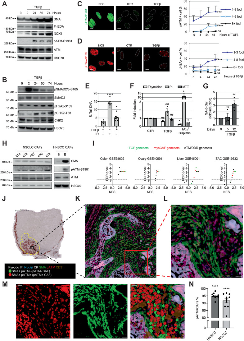 Figure 1. ATM activation in myofibroblasts. A–B, Western blotting of HFFF2 treated with TGFβ1 over time. C–D, Representative immunofluorescence staining of pATM- (C), pH2AX-positive (D) foci and quantification of HFFF2 treated over time with TGFβ1 or NCS (positive control); nuclei are outlined by dotted white lines based on Dapi nuclear counterstaining (not shown; scale bar = 10 μm). Foci counts are expressed as % of total cell number per FoV (FoV = ntr ≥ 8); SD and Kruskal–Wallis test are shown. E, Alkaline comet assay of HFFF2 treated with TGFβ1 for 24 hours or irradiated with 2 Gy (as positive control; ntr = 50; homoscedastic Student t test refers to the control). F, Analysis of viability, proliferation, and cell death monitored by MTT, thymidine incorporation, and PI staining, respectively. HFFF2 were treated for 3 days with TGFβ1 or with H2O2 or cisplatin as positive controls (ntr = 2–3). G, Senescence assay of HFFF2 treated with TGFβ1 over time. The percentage of SA-β-Gal–positive cells is expressed as fold induction compared with untreated control; FoV = ntr = 10. H, Western blotting of NSCLC and HNSCC CAF. I, Volcano plots with FDR q (significance) and NES (correlation) of GSEA performed on the indicated data sets from LCMD tumor versus normal stroma. The dotted line drawn at 1.3 of −log10 FDR q axis indicates FDR q = 0.05. J–N, Representative image of HNSCC MxIHC; bright field image of cytokeratin staining (scale bar = 5 mm J); pseudocolored images (scale bar = 100 μm K; scale bar = 20 μm L–M); single-stained and merged pseudocolored images with the cell regions used for the quantification highlighted in red or green for pATM or SMA positivity, respectively (subtracted CD31 staining shown in brown); quantification of pATM positivity in SMA+ cells (negative for CD31 and CK) in 10 HNSCC and 10 NSCLC cases (N) with significance calculated comparing pATM+/SMA+ vs. pATM−/SMA+ CAFs. Paired Student t test is used in the figure and refers to control unless otherwise stated.