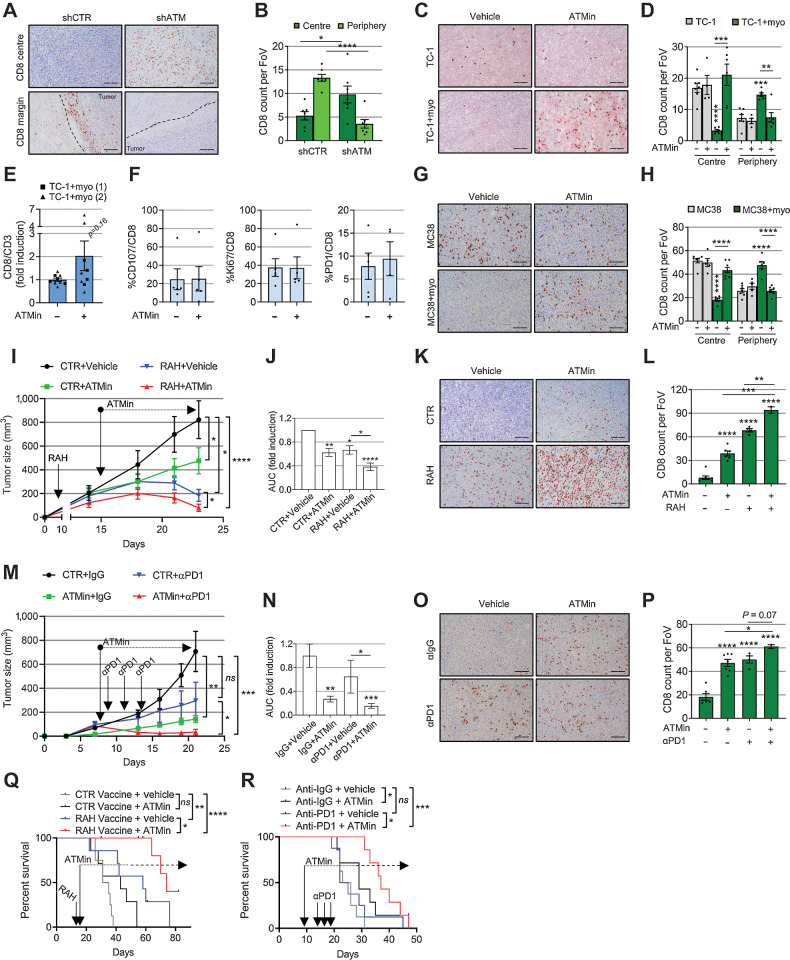 Figure 6. Targeting myofibroblast ATM promotes tumor CD8 T-cell infiltration and potentiates immunotherapy. A and B, Representative IHC staining (A) and relative quantification (B) of CD8 T cells in the core and periphery of TC-1 myo-rich tumors (described in Fig. 5F–J; ntr = FoV = 10; dotted lines highlight the tumor margins). C and D, Representative IHC staining (C) and relative quantification (D) of CD8 T cells in the core and periphery of tumors described in Fig. 5K (ntr = FoV = 10). E–F, Flow cytometry analysis from TC-1 + myo-rich tumors described in Fig. 5K (E shows two experiments; two-way ANOVA is used). G and H, Representative IHC staining (G) and relative quantification (H) of CD8 T cells in the core and periphery of the tumors described in Fig. 5P (ntr = FoV = 10). I–L, Mice were injected with TC-1 + myoMLF and treated with RAH vaccine±AZD0156. Control plasmid with vehicle was used as control. Tumor growth curves of a representative experiment (I; mouse number = 7–8; see also Supplementary Fig. S7a); two-way ANOVA is shown and refers to AUC analysis of three experiments (J). Representative IHC staining (K) and relative quantification of CD8 T cells in the tumor core (L; ntr = FoV = 10). M–P, Mice were injected with MC38 and myoMCF and treated with αPD-1 and AZD0156, either alone or in combination. Control mice received isotype control antibody and vehicle. Tumor growth curves of a single experiment (M; mouse number = 5–8; see also Supplementary Fig. S7b) and relative AUC analysis (N). Representative IHC staining (O) and relative quantification (P) of CD8 T cells in the tumor core (ntr = FoV = 10 in P). Q and R, Overall survival of mice injected with TC-1 + myoMLF (Q) or MC38 + myoMCF (R) and treated as indicated (mouse number = 7–8 for both experiments; Mantel–Cox log-rank test is shown; see also Supplementary Fig. S7c and S7d). Scale bars, 200 μm; a homoscedastic Student t test is used throughout the figure and is relative to the control unless otherwise highlighted.