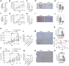 Figure 5. Targeting ATM in myofibroblasts reduces their intratumoral accumulation and slows tumor growth. A and F, qRT-PCR showing shRNA ATM knockdown in HFFF2 (A) or TGFβ1-treated MLF (myoMLF; F) prior to injection in mice (ntr = 3; SD shown). B, G, C, and H, Tumor growth curves (B and G) and AUC histograms (C and H) following coinjection of tumor cells with shCTR or shATM fibroblasts (5PT cells + HFFF2, B and C; TC-1 cells + myoMLF, G and H). Data from single experiments are presented; mouse numbers = 3–8 (B and G). Two-way ANOVA is used for AUC analysis of three individual experiments for both 5PT (C) and TC-1 models (H). D and I, Representative SMA IHC from the experiments shown in B and G, respectively. E and J, Quantification of SMA staining (ntr = FoV = 3) from the experiments shown in B (E) and G (J). K, L and P and Q, Mice injected with either TC-1 ± myoMLF (K and L) or MC38 ± TGFβ1-treated MCF (myoMCF; P and Q) were treated with ATM inhibitor AZD0156 for the duration of the experiment (mouse number = 5–8); tumor growth curves (K and P); AUC analysis of two experiments relative to K (two-way ANOVA, L); AUC analysis of the single experiment shown in P (homoscedastic Student t test, Q). M–N and R–S, Representative images and quantification of SMA IHC of mouse tumors in K and P, respectively (ntr = FoV = 3). O, Overall survival of TC-1 + myoMLF mice treated daily with AZD0156 at days 15–28 (mouse number = 11–12; Mantel–Cox log-rank test is shown; see also Supplementary Fig. S5k and S5l). Homoscedastic Student t test is shown in the figure and refers to the control unless otherwise highlighted. Scale bars, 200 μm.