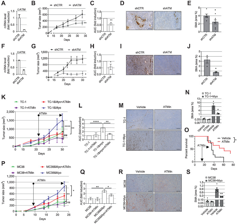 Figure 5. Targeting ATM in myofibroblasts reduces their intratumoral accumulation and slows tumor growth. A and F, qRT-PCR showing shRNA ATM knockdown in HFFF2 (A) or TGFβ1-treated MLF (myoMLF; F) prior to injection in mice (ntr = 3; SD shown). B, G, C, and H, Tumor growth curves (B and G) and AUC histograms (C and H) following coinjection of tumor cells with shCTR or shATM fibroblasts (5PT cells + HFFF2, B and C; TC-1 cells + myoMLF, G and H). Data from single experiments are presented; mouse numbers = 3–8 (B and G). Two-way ANOVA is used for AUC analysis of three individual experiments for both 5PT (C) and TC-1 models (H). D and I, Representative SMA IHC from the experiments shown in B and G, respectively. E and J, Quantification of SMA staining (ntr = FoV = 3) from the experiments shown in B (E) and G (J). K, L and P and Q, Mice injected with either TC-1 ± myoMLF (K and L) or MC38 ± TGFβ1-treated MCF (myoMCF; P and Q) were treated with ATM inhibitor AZD0156 for the duration of the experiment (mouse number = 5–8); tumor growth curves (K and P); AUC analysis of two experiments relative to K (two-way ANOVA, L); AUC analysis of the single experiment shown in P (homoscedastic Student t test, Q). M–N and R–S, Representative images and quantification of SMA IHC of mouse tumors in K and P, respectively (ntr = FoV = 3). O, Overall survival of TC-1 + myoMLF mice treated daily with AZD0156 at days 15–28 (mouse number = 11–12; Mantel–Cox log-rank test is shown; see also Supplementary Fig. S5k and S5l). Homoscedastic Student t test is shown in the figure and refers to the control unless otherwise highlighted. Scale bars, 200 μm.