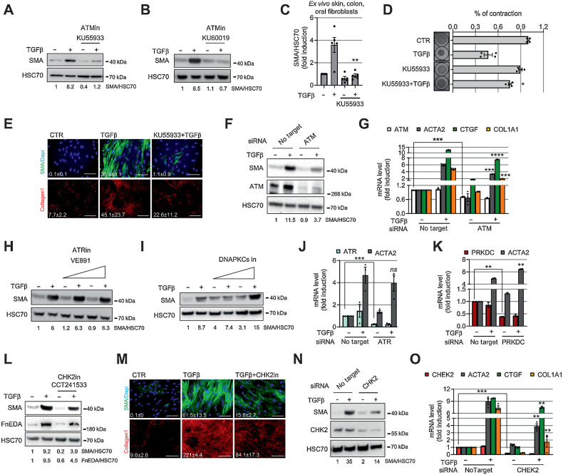 Figure 2. ATM inhibition suppresses myofibroblast differentiation. A and B, Western blotting and its quantification of HFFF2 treated for 72 hours with TGFβ1 ± ATM inhibitors (13.3 μmol/L KU55933, A; 2.5 μmol/L KU60019, B). C, Western blotting quantification of SMA expression in primary fibroblasts isolated ex vivo from colon (n = 2), skin (n = 1), and oral (n = 2) tissues from healthy donors. Fibroblasts were treated as in A (see also Supplementary Fig. S2C–G). D, Collagen gel contraction assay and measurement of gel area. HFFF2 or normal primary oral fibroblasts were treated as in A. Representative gel images shown on the left (ntr = 2). E, Representative immunofluorescence staining of SMA-positive stress fibers or collagen 1 deposition in HFFF2 treated with TGFβ1 ± ATM inhibitor as above for 3 (SMA) or 7 (collagen 1) days; relative quantification of the mean (FoV for both SMA and collagen 1 = 10); scale bars for SMA = 100 μm and for collagen 1 = 500 μm). F and G, Western blotting/quantification (F) and qRT-PCR (ntr = 3; G) of HFFF2 transfected as indicated and treated with TGFβ1 for 72 hours (ACTA2 = SMA gene). H–I, Western blotting and quantification of HFFF2 fibroblast treated for 72 hours with TGFβ1 ± ATR inhibitor (VE891; 0.5 μmol/L and 2.5 μmol/L; H) or ± DNA-PKcs inhibitor (2 μmol/L and 10 μmol/L; I) for 72 hours. J and K, qRT-PCR of HFFF2 transfected as indicated and treated with TGFβ1 for 72 hours (ntr = 3; PRKDC = DNA-PKcs). L, Western blotting and quantification of HFFF2 treated for 72 hours with TGFβ1 ± CHK2 inhibitor (1.5 μmol/L CCT241533). M, Representative immunofluorescence staining of SMA and collagen 1 in HFFF2 treated with TGFβ1 ± CHK2 inhibitor (quantified as in E). N–O, Western blotting/quantification (N) and qRT-PCR (O; ntr = 3) of HFFF2 transfected as indicated and treated with TGFβ1 for 72 hours. Heteroscedastic Student t test is used throughout the figure and is relative to TGFβ1-treated samples unless otherwise highlighted.