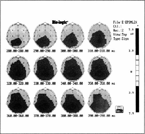 Figure 2a.