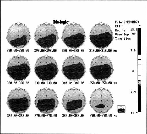 Figure 1b.